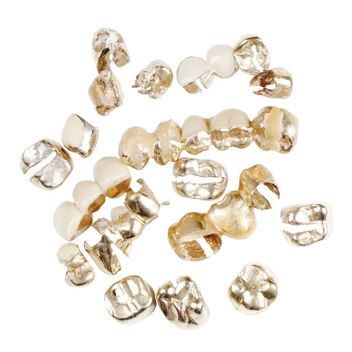 Dental gold crowns and bridges we buy for their gold content