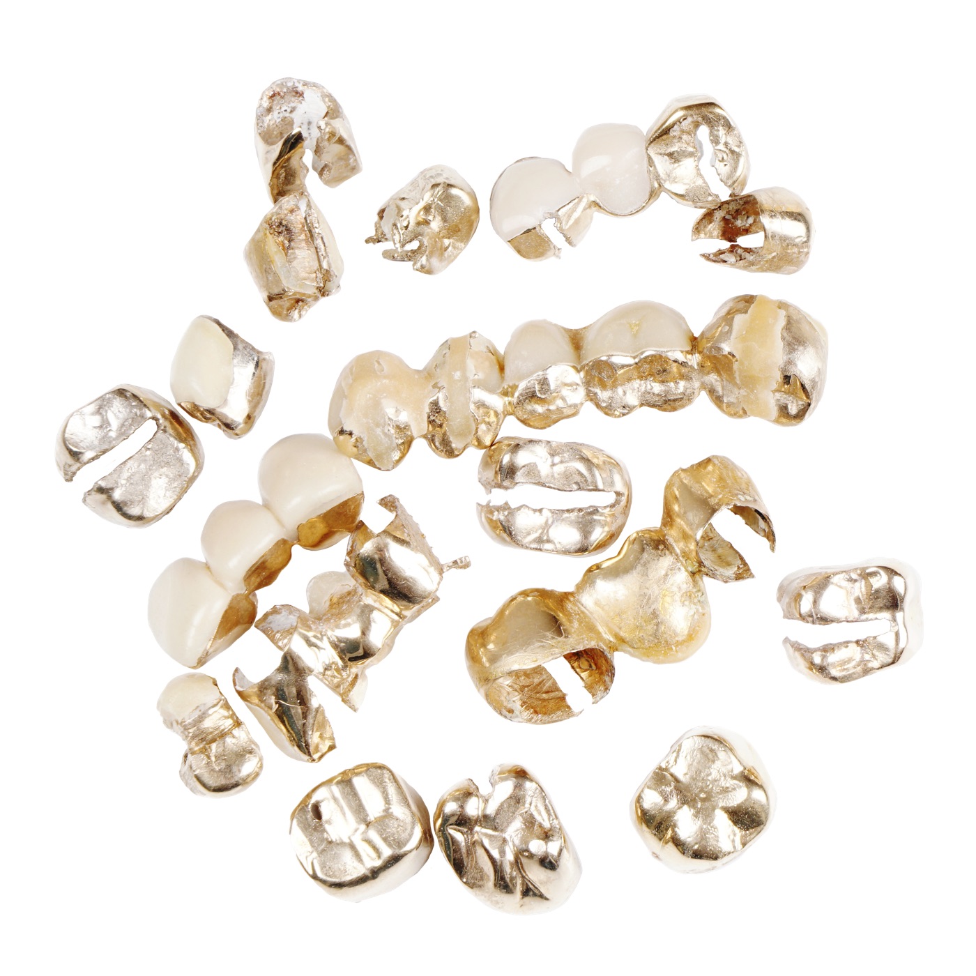 Dental Gold we buy in Salem
