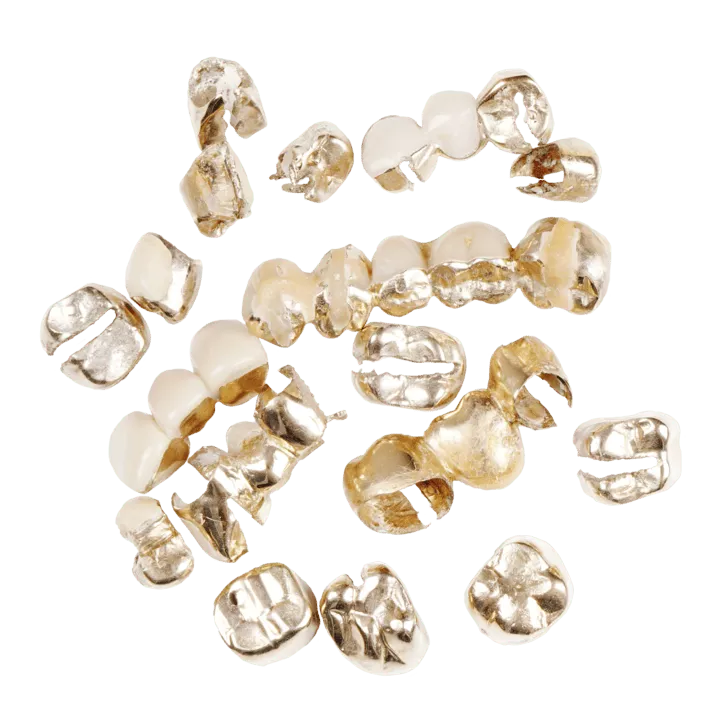Dental Gold